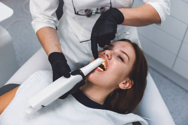 Best Emergency Root Canal Treatment in Fountainebleau, FL